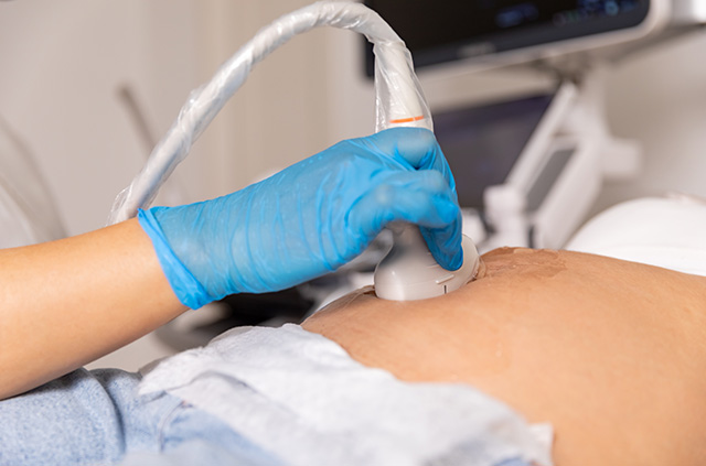 超音波検査 イメージ