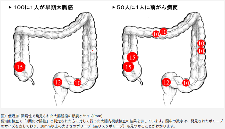 内視鏡検査 がん発生率